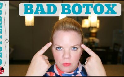 My Bad Botox Experience